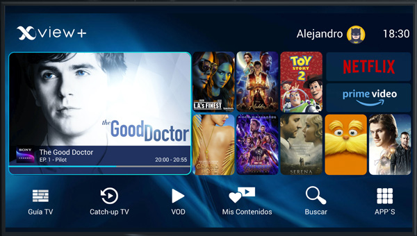 Xview, Megacable